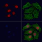 Phospho-CHOP (Ser30) Antibody in Immunocytochemistry (ICC/IF)