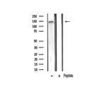 Phospho-VEGF Receptor 2 (Tyr1059) Antibody in Western Blot (WB)