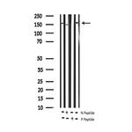 Phospho-VEGF Receptor 2 (Tyr951) Antibody in Western Blot (WB)