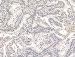 Phospho-PPAR gamma (Ser112) Antibody in Immunohistochemistry (Paraffin) (IHC (P))