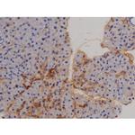 Phospho-STAT6 (Tyr641) Antibody in Immunohistochemistry (Paraffin) (IHC (P))