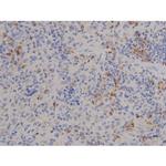 Phospho-STAT6 (Tyr641) Antibody in Immunohistochemistry (Paraffin) (IHC (P))