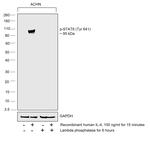 Phospho-STAT6 (Tyr641) Antibody