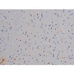 Phospho-STAT6 (Thr645) Antibody in Immunohistochemistry (Paraffin) (IHC (P))