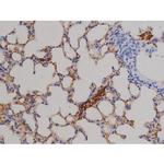 Phospho-STAT6 (Thr645) Antibody in Immunohistochemistry (Paraffin) (IHC (P))