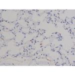 Phospho-STAT6 (Thr645) Antibody in Immunohistochemistry (Paraffin) (IHC (P))