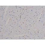 Phospho-STAT6 (Thr645) Antibody in Immunohistochemistry (Paraffin) (IHC (P))