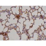 Phospho-STAT6 (Thr645) Antibody in Immunohistochemistry (Paraffin) (IHC (P))