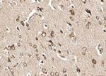 Phospho-GluR1 (Ser863) Antibody in Immunohistochemistry (Paraffin) (IHC (P))