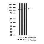 Phospho-GluR1 (Ser863) Antibody in Western Blot (WB)