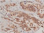 Phospho-Caspase 3 (Ser150) Antibody in Immunohistochemistry (Paraffin) (IHC (P))