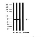 Phospho-Caspase 3 (Ser150) Antibody in Western Blot (WB)