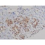 Phospho-ZAP-70 (Tyr319) Antibody in Immunohistochemistry (Paraffin) (IHC (P))