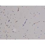 Phospho-ZAP-70 (Tyr319) Antibody in Immunohistochemistry (Paraffin) (IHC (P))