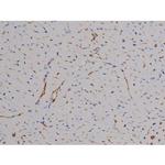 Phospho-ZAP-70 (Tyr319) Antibody in Immunohistochemistry (Paraffin) (IHC (P))