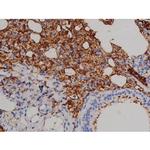 Phospho-ZAP-70 (Tyr319) Antibody in Immunohistochemistry (Paraffin) (IHC (P))