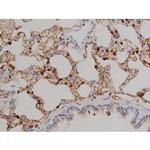 Phospho-ZAP-70 (Tyr319) Antibody in Immunohistochemistry (Paraffin) (IHC (P))