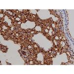 Phospho-ZAP-70 (Tyr319) Antibody in Immunohistochemistry (Paraffin) (IHC (P))