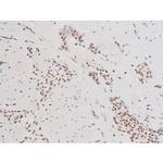 Phospho-SYK (Tyr348) Antibody in Immunohistochemistry (Paraffin) (IHC (P))