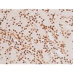 Phospho-SYK (Tyr348) Antibody in Immunohistochemistry (Paraffin) (IHC (P))