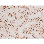 Phospho-SYK (Tyr348) Antibody in Immunohistochemistry (Paraffin) (IHC (P))