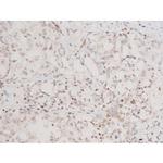 Phospho-SYK (Tyr348) Antibody in Immunohistochemistry (Paraffin) (IHC (P))