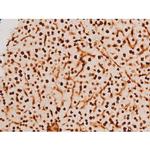 Phospho-SYK (Tyr348) Antibody in Immunohistochemistry (Paraffin) (IHC (P))