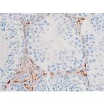 Phospho-SYK (Tyr348) Antibody in Immunohistochemistry (Paraffin) (IHC (P))