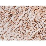 Phospho-SYK (Tyr348) Antibody in Immunohistochemistry (Paraffin) (IHC (P))