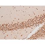 Phospho-SYK (Tyr348) Antibody in Immunohistochemistry (Paraffin) (IHC (P))