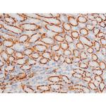 Phospho-SYK (Tyr348) Antibody in Immunohistochemistry (Paraffin) (IHC (P))