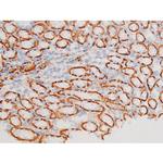 Phospho-SYK (Tyr348) Antibody in Immunohistochemistry (Paraffin) (IHC (P))