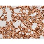 Phospho-SYK (Tyr348) Antibody in Immunohistochemistry (Paraffin) (IHC (P))