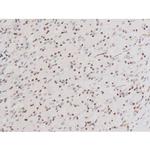 Phospho-SYK (Tyr525) Antibody in Immunohistochemistry (Paraffin) (IHC (P))