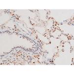 Phospho-SYK (Tyr525) Antibody in Immunohistochemistry (Paraffin) (IHC (P))