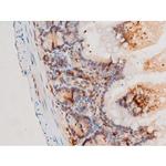 Phospho-SYK (Tyr525) Antibody in Immunohistochemistry (Paraffin) (IHC (P))