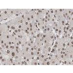 Phospho-JNK1/JNK2/JNK3 (Tyr185) Antibody in Immunohistochemistry (Paraffin) (IHC (P))