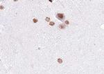 Phospho-MAP2K4 (Ser80) Antibody in Immunohistochemistry (Paraffin) (IHC (P))