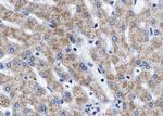 Phospho-TSC2 (Thr1462) Antibody in Immunohistochemistry (Paraffin) (IHC (P))