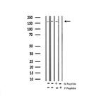 Phospho-TSC2 (Thr1462) Antibody in Western Blot (WB)