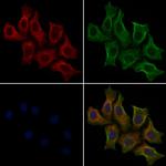 Phospho-TSC2 (Thr1462) Antibody in Immunocytochemistry (ICC/IF)