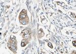 Phospho-STAT5 beta (Ser731) Antibody in Immunohistochemistry (Paraffin) (IHC (P))