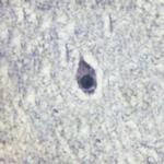 Phospho-Calmodulin 1/2/3 (Thr80, Ser82) Antibody in Immunohistochemistry (Paraffin) (IHC (P))