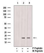 Phospho-Calmodulin 1/2/3 (Thr80, Ser82) Antibody in Western Blot (WB)