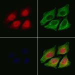 Phospho-Smad3 (Ser425) Antibody in Immunocytochemistry (ICC/IF)