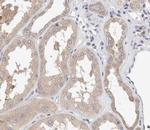 Phospho-Smad3 (Ser425) Antibody in Immunohistochemistry (Paraffin) (IHC (P))