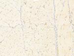 Phospho-Smad3 (Ser425) Antibody in Immunohistochemistry (Paraffin) (IHC (P))