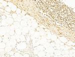 Phospho-Smad3 (Ser425) Antibody in Immunohistochemistry (Paraffin) (IHC (P))