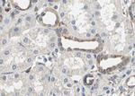 Phospho-Smad3 (Thr179) Antibody in Immunohistochemistry (Paraffin) (IHC (P))