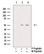 Phospho-Smad3 (Thr179) Antibody in Western Blot (WB)